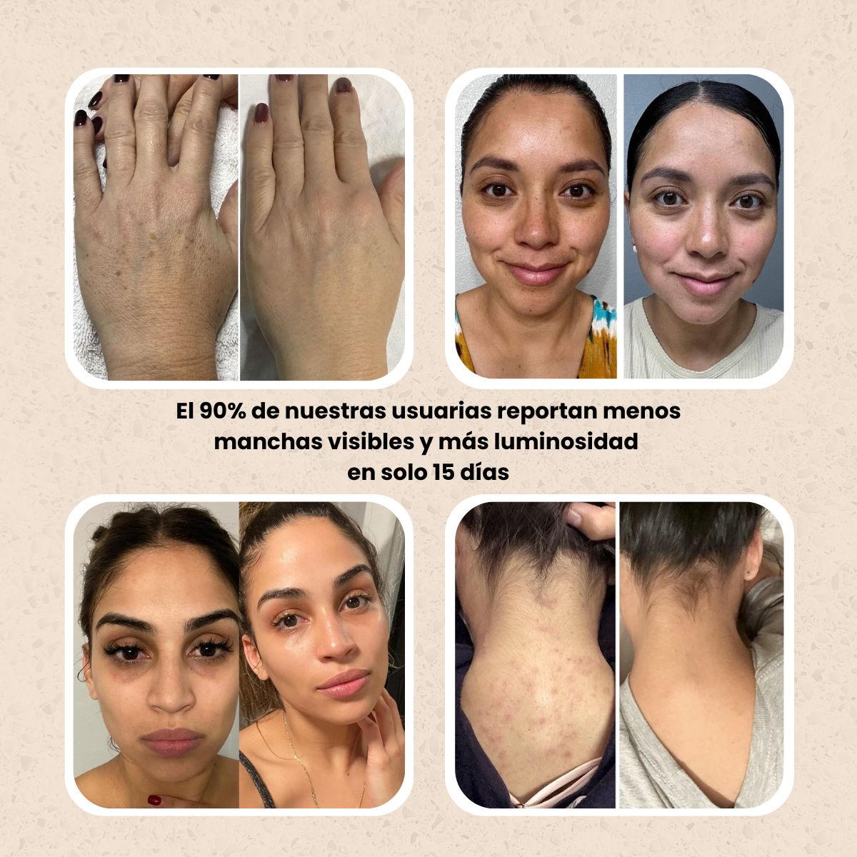 KURMI - Ritual Iluminador Antimanchas