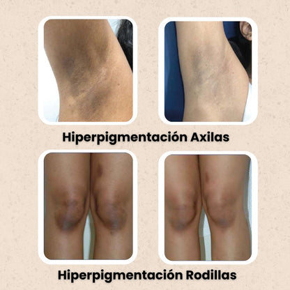 KURMI - Ritual Iluminador Antimanchas