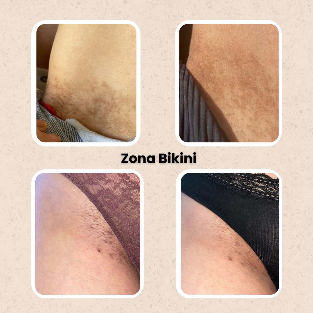 KURMI - Ritual Iluminador Antimanchas