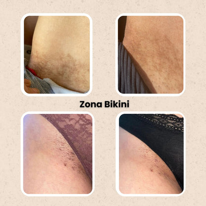 KURMI - Ritual Iluminador Antimanchas