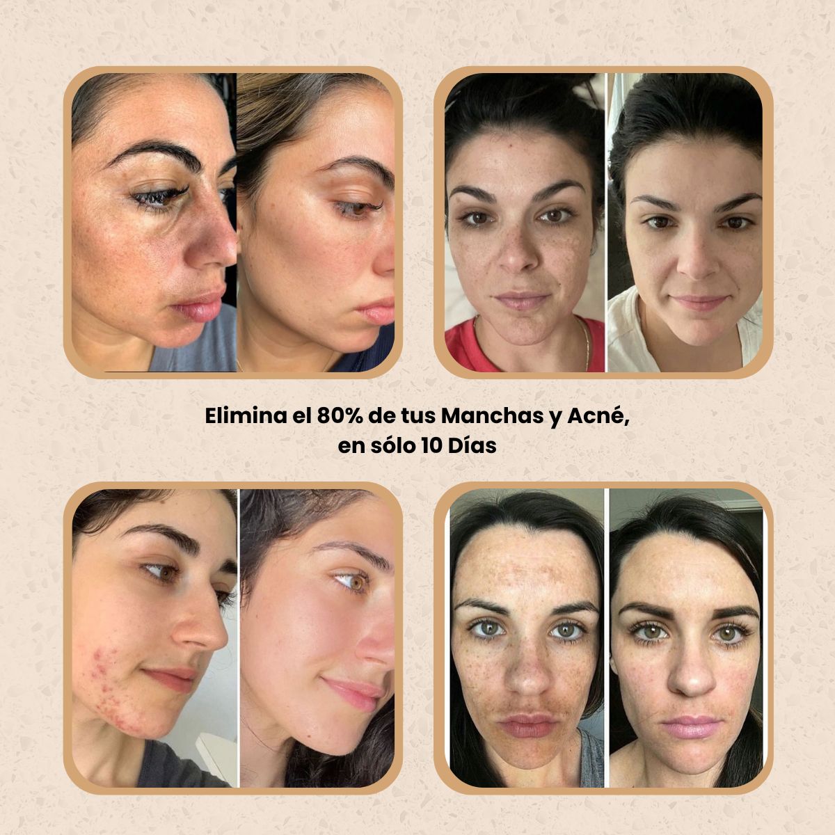 KURMI - Sérum Corrector de Manchas