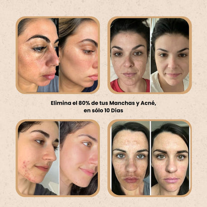 KURMI - Sérum Corrector de Manchas